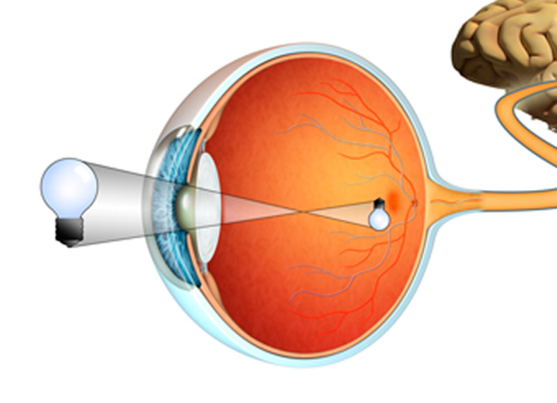 Tratamientos de retina
